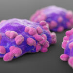 Le lymphome folliculaire